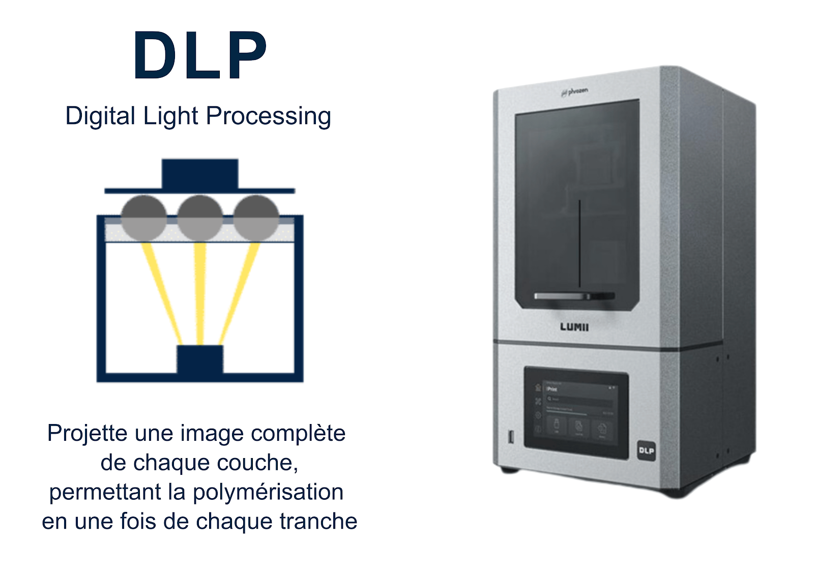 Impression résine dlp